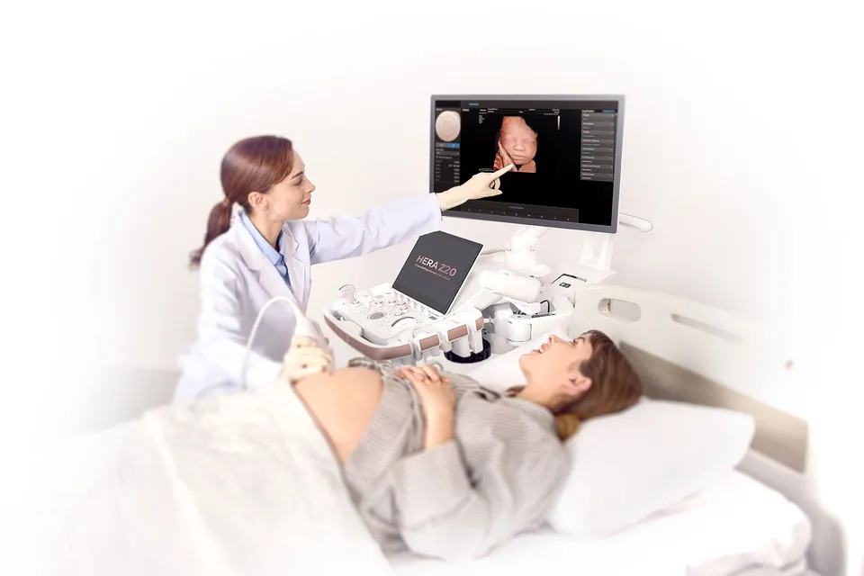 Médica mostra no monitor do HERA Z20 a imagem 3D do bebê para a gestante, deitada na maca